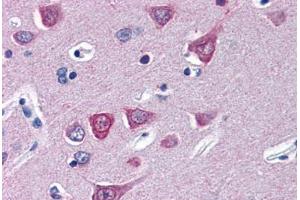 Human Brain, Cortex (formalin-fixed, paraffin-embedded) stained with SOCS1 antibody ABIN343904 at 5 ug/ml followed by biotinylated goat anti-rabbit IgG secondary antibody ABIN481713, alkaline phosphatase-streptavidin and chromogen. (SOCS1 抗体  (N-Term))