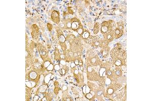 Immunohistochemistry (IHC) image for anti-Ferritin, Light Polypeptide (FTL) (AA 1-175) antibody (ABIN6140791)