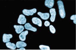Immunofluorescence staining of HeLa cells (Human cervical epitheloid carcinoma, ATCC CCL-2. (XRCC5 抗体  (AA 103-315))