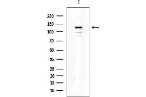 Western blot analysis of lysates from HepG2 cells(LPS 4h treatment), using SREBP2 Mouse Monoclonal Antibody at 1/1000 dilution.