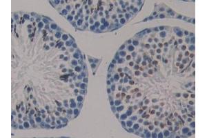 Immunohistochemistry (IHC) image for anti-Klotho (KL) (AA 516-955) antibody (ABIN7436549)