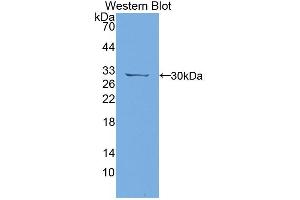 Western Blotting (WB) image for anti-Protein tyrosine Phosphatase, Receptor Type, J (PTPRJ) (AA 1033-1277) antibody (ABIN5014202)