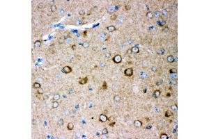 Anti- GRIA2 antibody, IHC(P) IHC(P): Mouse Brain Tissue (GRIA2 抗体  (AA 25-360))