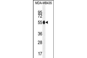 X1 Antibody (N-term) (ABIN655649 and ABIN2845124) western blot analysis in MDA-M cell line lysates (35 μg/lane). (PAX1 抗体  (N-Term))