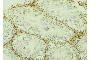 ABIN6277187 at 1/100 staining Mouse testis tissue by IHC-P. (DNMT3L 抗体  (Internal Region))