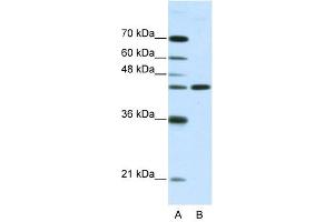 NMUR2 antibody used at 2.