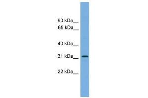 DAPP1 antibody used at 1 ug/ml to detect target protein. (DAPP1 抗体  (Middle Region))