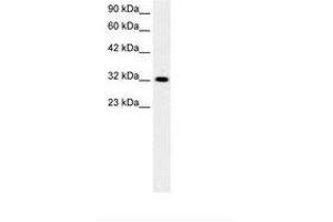 Image no. 1 for anti-E2F5 (E2F5) (AA 134-183) antibody (ABIN6736272) (E2F5 抗体  (AA 134-183))