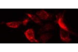 ABIN6274752 staining HuvEc cells by IF/ICC. (RPS20 抗体  (Internal Region))