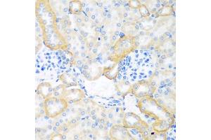 Immunohistochemistry of paraffin-embedded mouse kidney using CEACAM7 antibody (ABIN5974489) at dilution of 1/100 (40x lens). (CEACAM7 抗体)