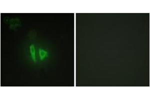 Immunofluorescence analysis of HepG2 cells, using AKAP11 Antibody. (AKAP11 抗体  (AA 1761-1810))
