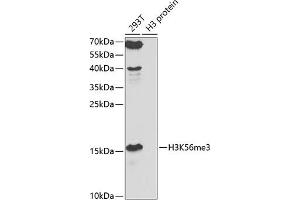 Western blot analysis of extracts of various cell lines, using TriMethyl-Histone H3-K56 antibody (ABIN7267700) at 1:1000 dilution.