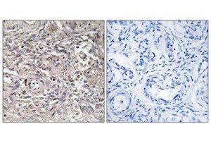 Immunohistochemistry (IHC) image for anti-Claudin 6 (CLDN6) (Internal Region) antibody (ABIN1851126) (Claudin 6 抗体  (Internal Region))
