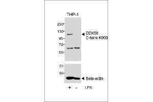 Western blot analysis of lysates from THP-1 cell line, untreated or treated with LPS, 1 μg/mL, using DDX58 C-term (upper) or Beta-actin (lower). (DDX58 抗体  (C-Term))