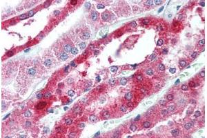 Human Kidney (formalin-fixed, paraffin-embedded) stained with OCLN antibody ABIN305888 at 2. (Occludin 抗体  (C-Term))