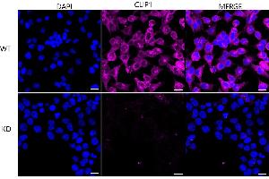 Immunocytochemical staining of HeLa cells using CLIP1 antibody (ABIN7797861), 1:1,000), Top panel: wild-type (WT), Bottom panal: CLIP1 shRNA knockdown (KD). (Recombinant CLIP1 抗体)
