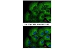 ICC/IF Image Immunofluorescence analysis of methanol-fixed H1299, using MMP12, antibody at 1:500 dilution. (MMP12 抗体)