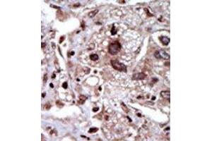 Image no. 1 for anti-serine threonine Kinase 39 (STK39) (Middle Region) antibody (ABIN360385) (STK39 抗体  (Middle Region))