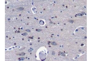 Detection of Grb7 in Porcine Cerebrum Tissue using Polyclonal Antibody to Growth Factor Receptor Bound Protein 7 (Grb7) (GRB7 抗体  (AA 66-327))