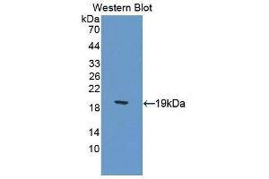 Western blot analysis of the recombinant protein. (Calcitonin Receptor 抗体  (AA 42-170))