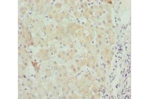 Immunohistochemistry of paraffin-embedded human liver tissue using ABIN7171258 at dilution of 1:100 (STXBP2 抗体  (AA 1-280))