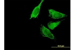 Immunofluorescence of purified MaxPab antibody to BCKDK on HeLa cell. (BCKDK 抗体  (AA 1-412))