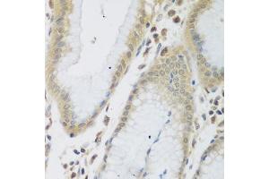 Immunohistochemistry of paraffin-embedded human stomach using ENPEP antibody  at dilution of 1:200 (40x lens). (ENPEP 抗体  (AA 708-957))