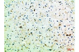 Immunohistochemical analysis of paraffin-embedded Human-brain, antibody was diluted at 1:100 (FZD4 抗体  (AA 11-60))