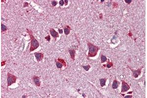 Human Brain, Cortex: Formalin-Fixed, Paraffin-Embedded (FFPE) (Neuregulin 3 抗体  (AA 540-589))
