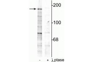Western blot of rat hippocampal lysate showing specific immunolabeling of the ~180 kDa NR2B subunit phosphorylated at Tyr1252 in the first lane (-). (GRIN2B 抗体  (pTyr1252))
