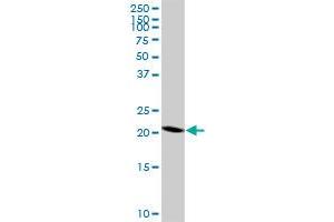 RNF182 polyclonal antibody (A01), Lot # 060802QCS1. (RNF182 抗体  (AA 1-99))