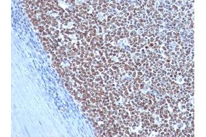 Immunohistochemistry (IHC) image for anti-Cyclin B1 (CCNB1) antibody (ABIN6940990)