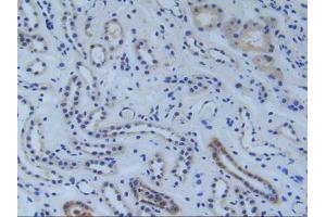 Figure. (RFTN1 抗体  (AA 288-520))