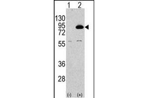 Western blot analysis of PIK3R2 Antibody (N-term) polyclonal antibody (ABIN392580 and ABIN2842115) (arrow). (PIK3R2 抗体  (N-Term))
