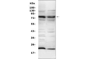 Western blot analysis of Complement C9 using anti-Complement C9 antibody (ABIN5692808).