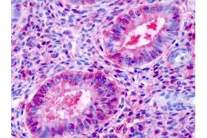Anti-ESRRB / ERR-Beta antibody IHC of human uterus, endometrial glands. (ESRRB 抗体  (N-Term))
