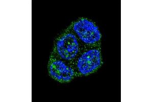 Confocal immunofluorescent analysis of FAS Antibody (Center) (ABIN652469 and ABIN2842320) with T47D cell followed by Alexa Fluor 488-conjugated goat anti-rabbit lgG (green). (FAS 抗体  (AA 185-211))