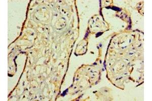 Immunohistochemistry of paraffin-embedded human placenta tissue using ABIN7175818 at dilution of 1:100 (WT1 抗体  (AA 1-449))