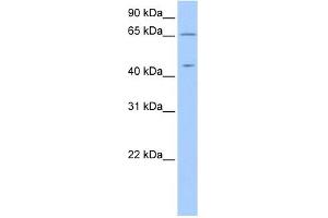 ZPLD1 antibody used at 1 ug/ml to detect target protein. (ZPLD1 抗体  (C-Term))