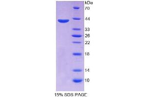SDS-PAGE analysis of Human ABCA4 Protein. (ABCA4 蛋白)