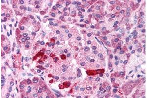 Immunohistochemistry (IHC) image for anti-Transient Receptor Potential Cation Channel, Subfamily M, Member 4 (TRPM4) (C-Term) antibody (ABIN1049434)