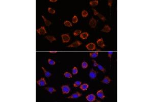 Immunofluorescence analysis of L929 cells using RPL35 antibody (ABIN7270004) at dilution of 1:100. (RPL35 抗体  (AA 50-120))