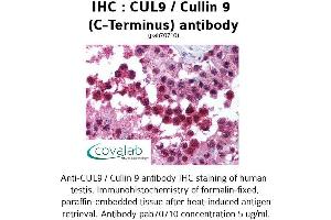 Image no. 1 for anti-Cullin 9 (CUL9) antibody (ABIN1733383) (CUL9 抗体)