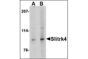 Western blot analysis of Slitrk4 in mouse brain tissue lysate with this product at (A) 0. (SLITRK4 抗体  (C-Term))