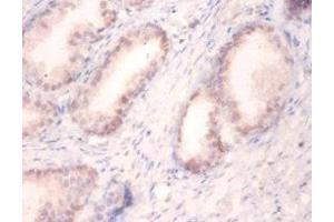 Immunohistochemistry of paraffin-embedded human prostate tissue using ABIN7174131 at dilution of 1:100 (SNRPA1 抗体  (AA 8-278))