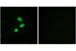 Immunofluorescence analysis of MCF7 cells, using TSH2 Antibody. (THNSL2 抗体  (AA 811-860))