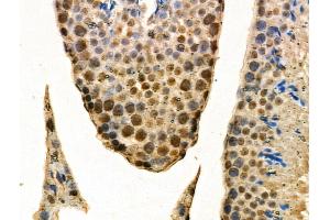 ABIN6257258 and ABIN6274281 at 1/100 staining Mouse testis tissue by IHC-P. (HNRNPF 抗体  (N-Term))