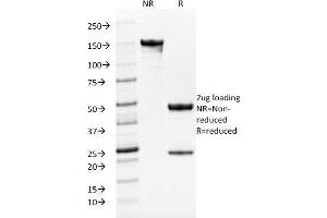SDS-PAGE Analysis Purified TYRP1-Monospecific Mouse Monoclonal Antibody (TYRP1/1986). (Tyrosinase-Related Protein 1 抗体  (AA 257-377))