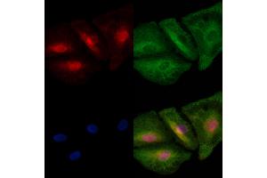 ABIN6259541 and ABIN6273711 staining  cells by IF/ICC.
