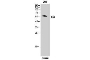 Western Blotting (WB) image for anti-Lymphocyte-Specific Protein tyrosine Kinase (LCK) (Ser738), (Ser742) antibody (ABIN3180148) (LCK 抗体  (Ser738, Ser742))
